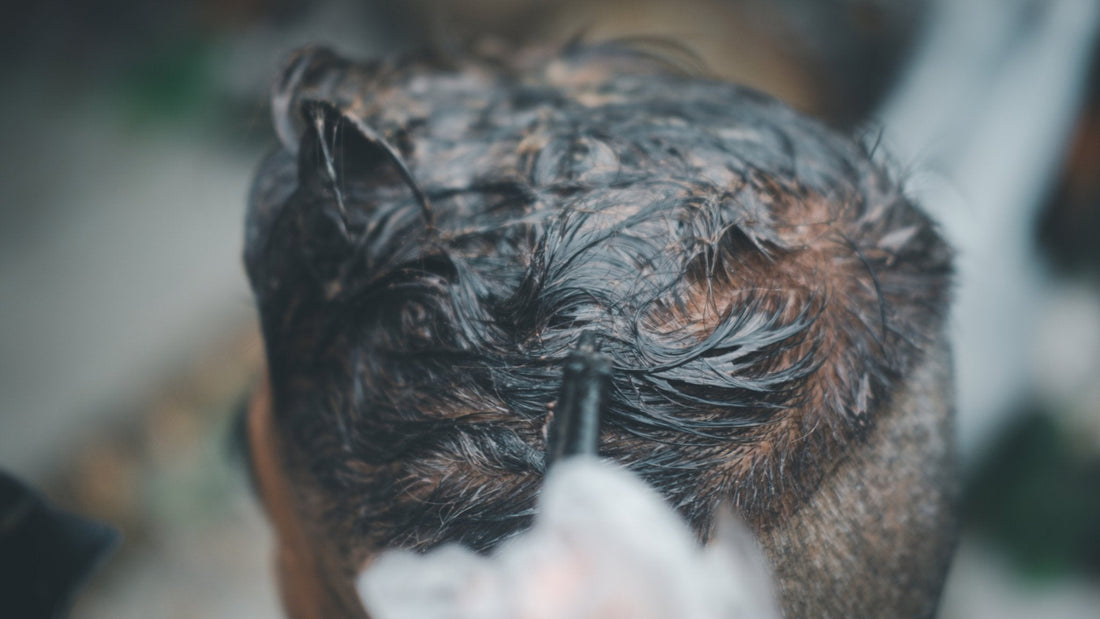 Trattamento Curativo per la Cute Uomo - La Base per Capelli Sani - Mat Hair Lab