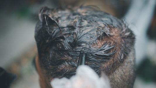 Trattamento Curativo per la Cute Uomo - La Base per Capelli Sani - Mat Hair Lab